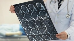 Deze AI-toepassingen zagen we al in de zorg