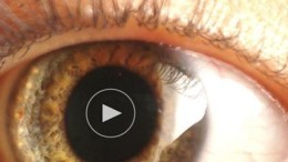 Google koopt trackertechnologie voor ogen