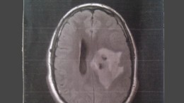 Waarschuwing voor de inzet van AI in de zorg