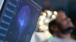 Zelfs neuraal netwerk heeft baat bij slaap