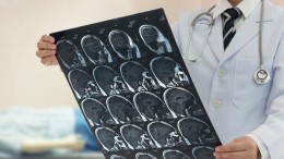 Techstartup in de zorg: zo pakt Nicolab het tijdsgevoelige karakter van beroertes aan